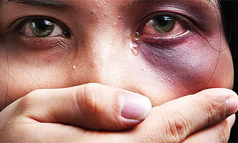 العنف ضد المرأة ومواجهته